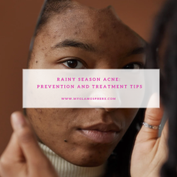 Rainy Season Acne: Prevention and Treatment Tips